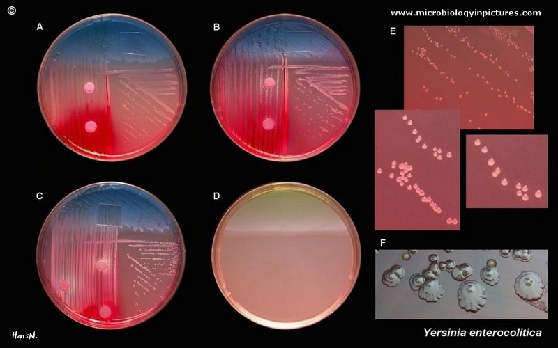 Yersinia enterocolitica